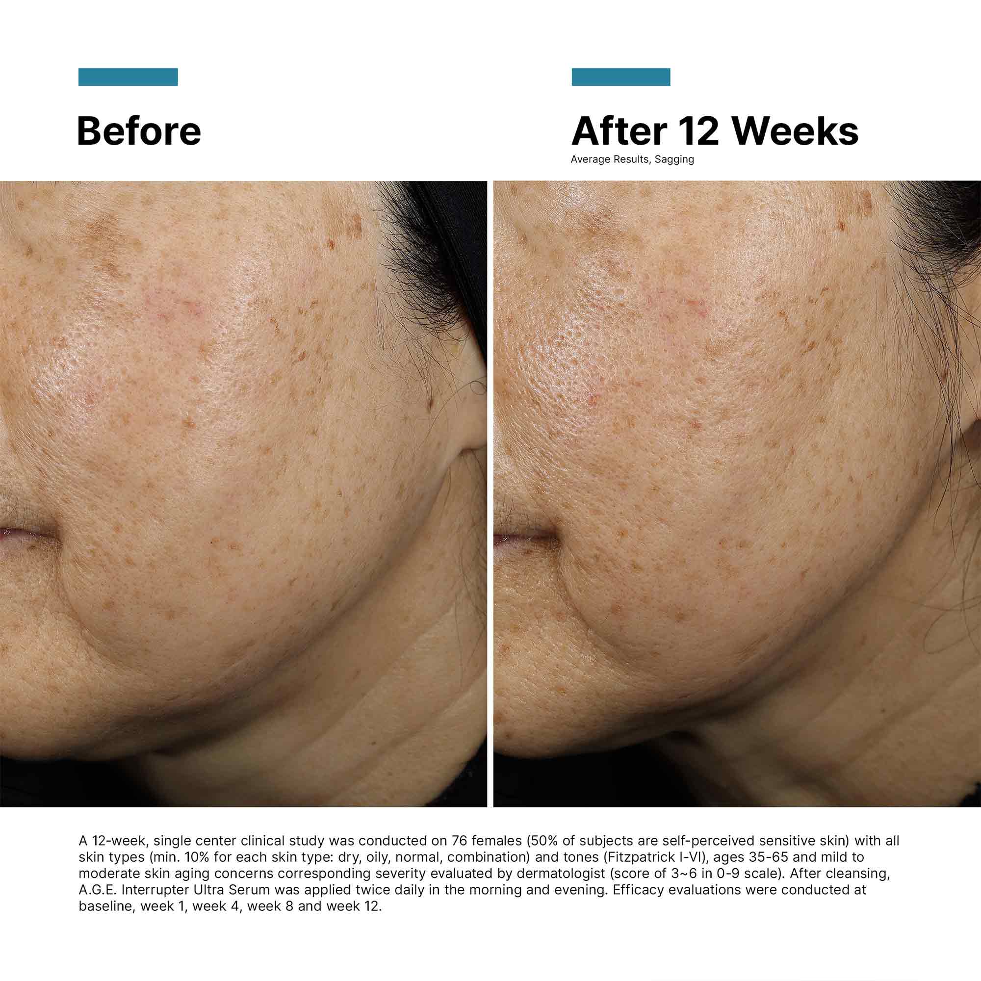 1170-a-g-e-interrupter-ultra-lifting-serum-5.jpg A.G.E. Interrupter Ultra Lifting Serum