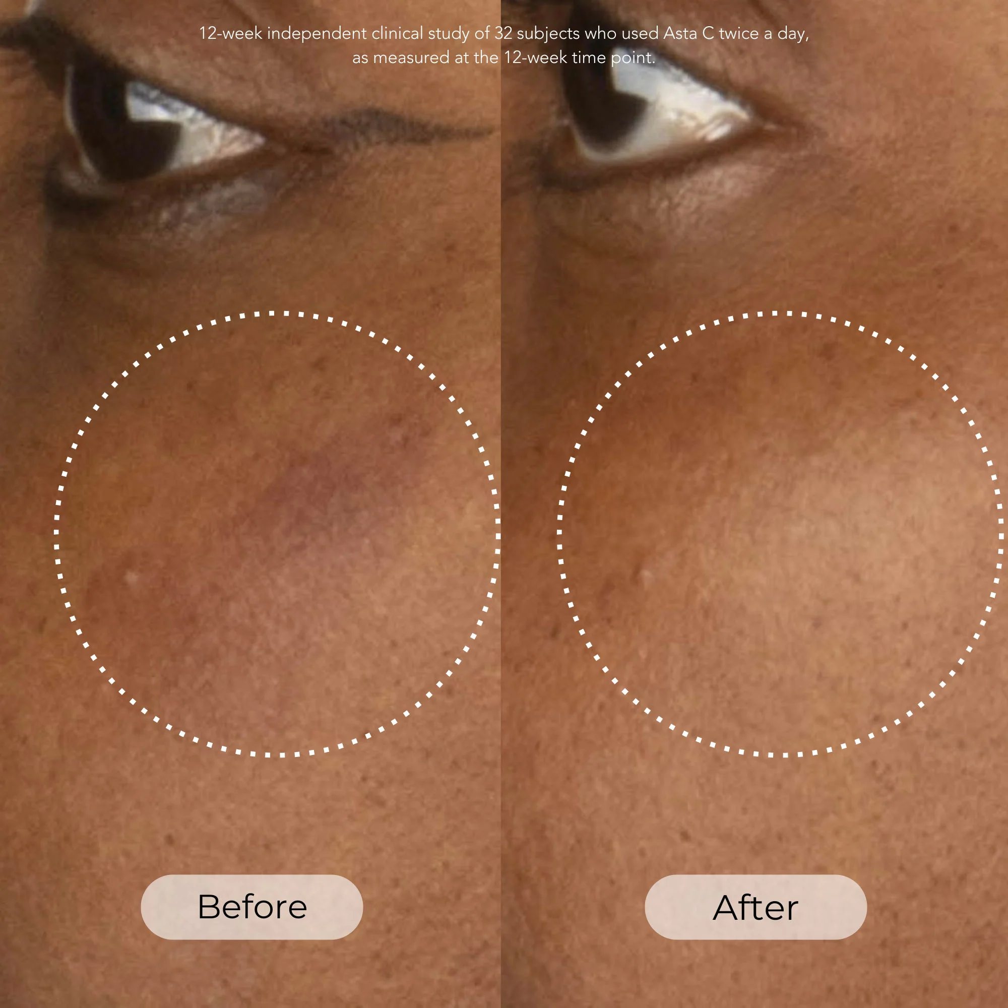 1815-asta-c-vitamin-c-age-defense-serum-2.webp Asta C Vitamin C Age Defense Serum