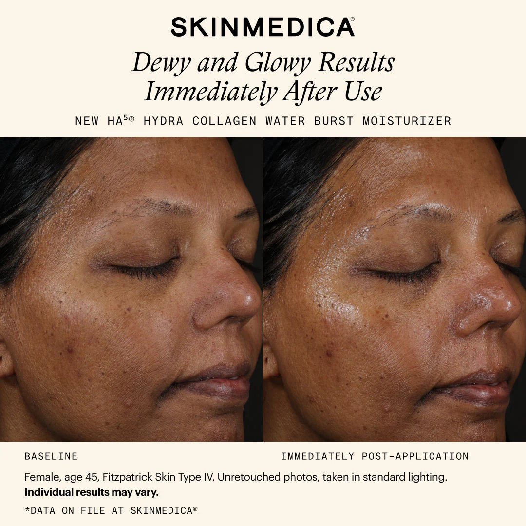 257-ha5-hydra-collagen-water-burst-moisturizer-10.webp HA5 Hydra Collagen Water Burst Moisturizer