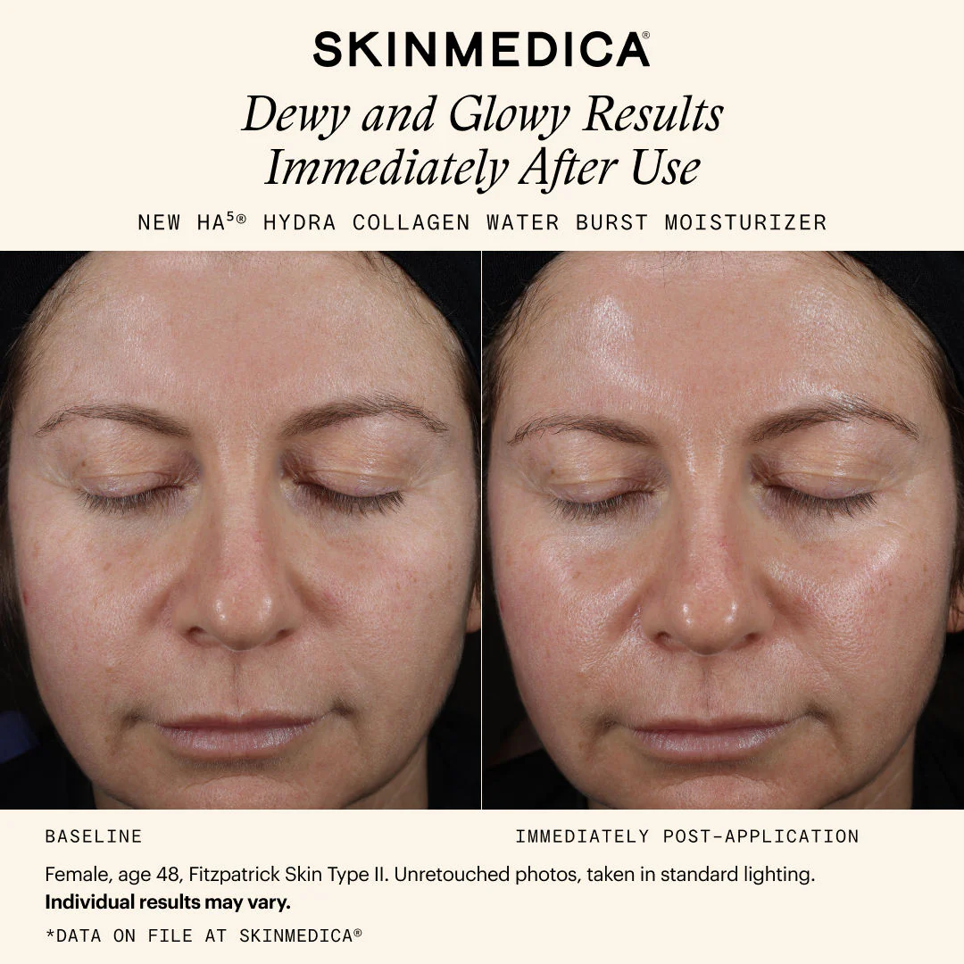 257-ha5-hydra-collagen-water-burst-moisturizer-11.webp HA5 Hydra Collagen Water Burst Moisturizer