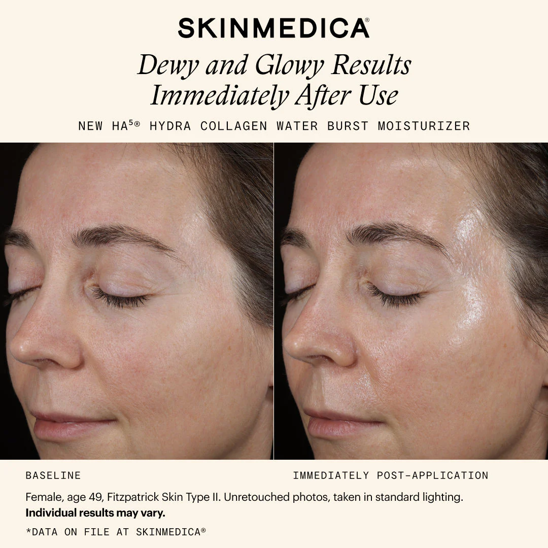 257-ha5-hydra-collagen-water-burst-moisturizer-8.webp HA5 Hydra Collagen Water Burst Moisturizer