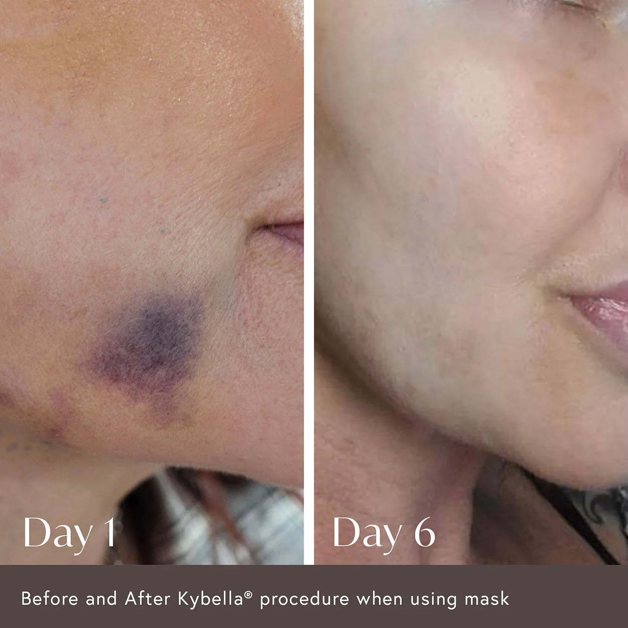 2991-ciao-for-now-post-injection-care-mask-3.webp Ciao For Now Post Injection Care Mask