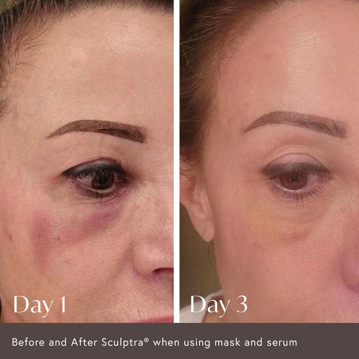 2991-ciao-for-now-post-injection-care-mask-4.webp Ciao For Now Post Injection Care Mask