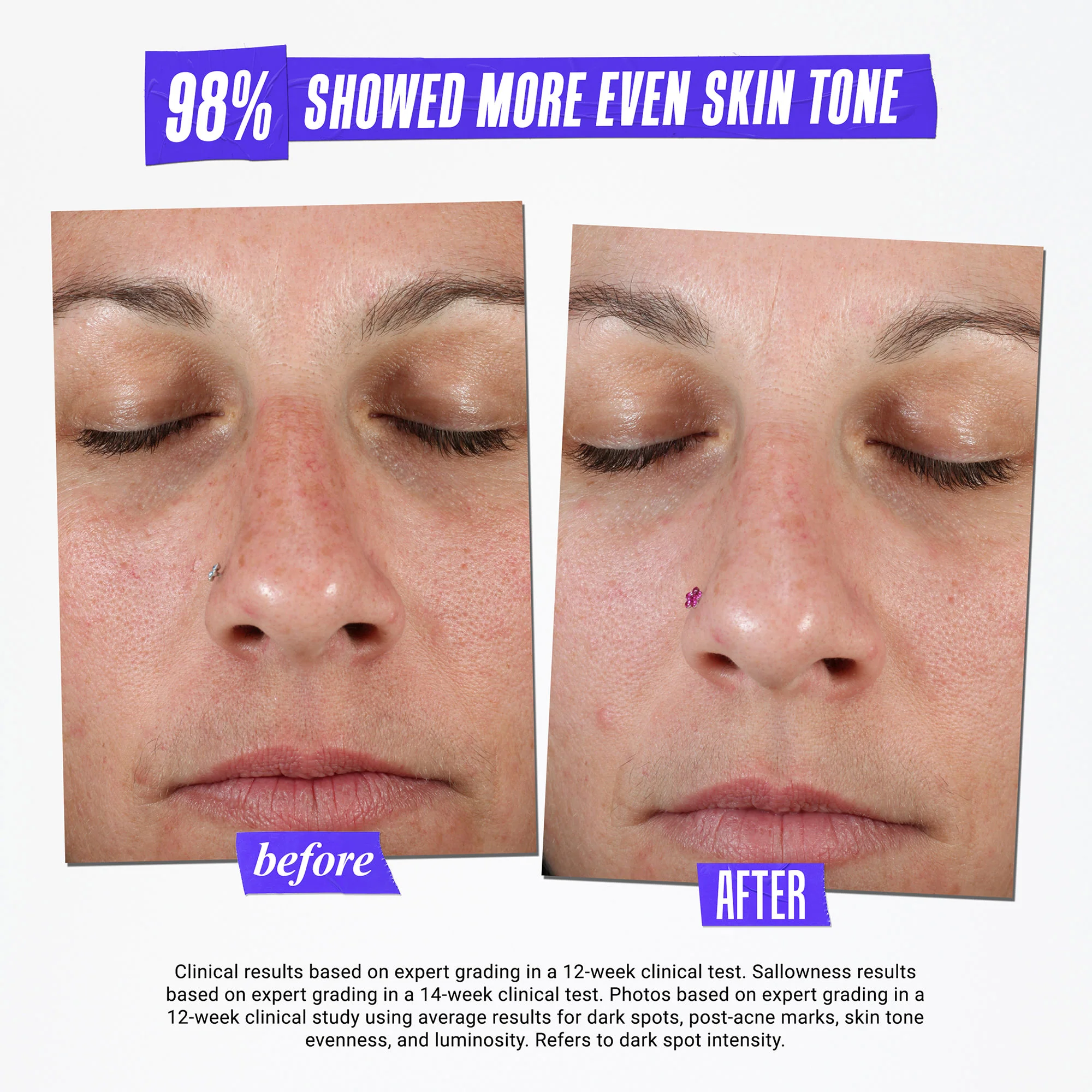 3095-clearly-corrective-dark-spot-solution-5.webp Clearly Corrective Dark Spot Solution