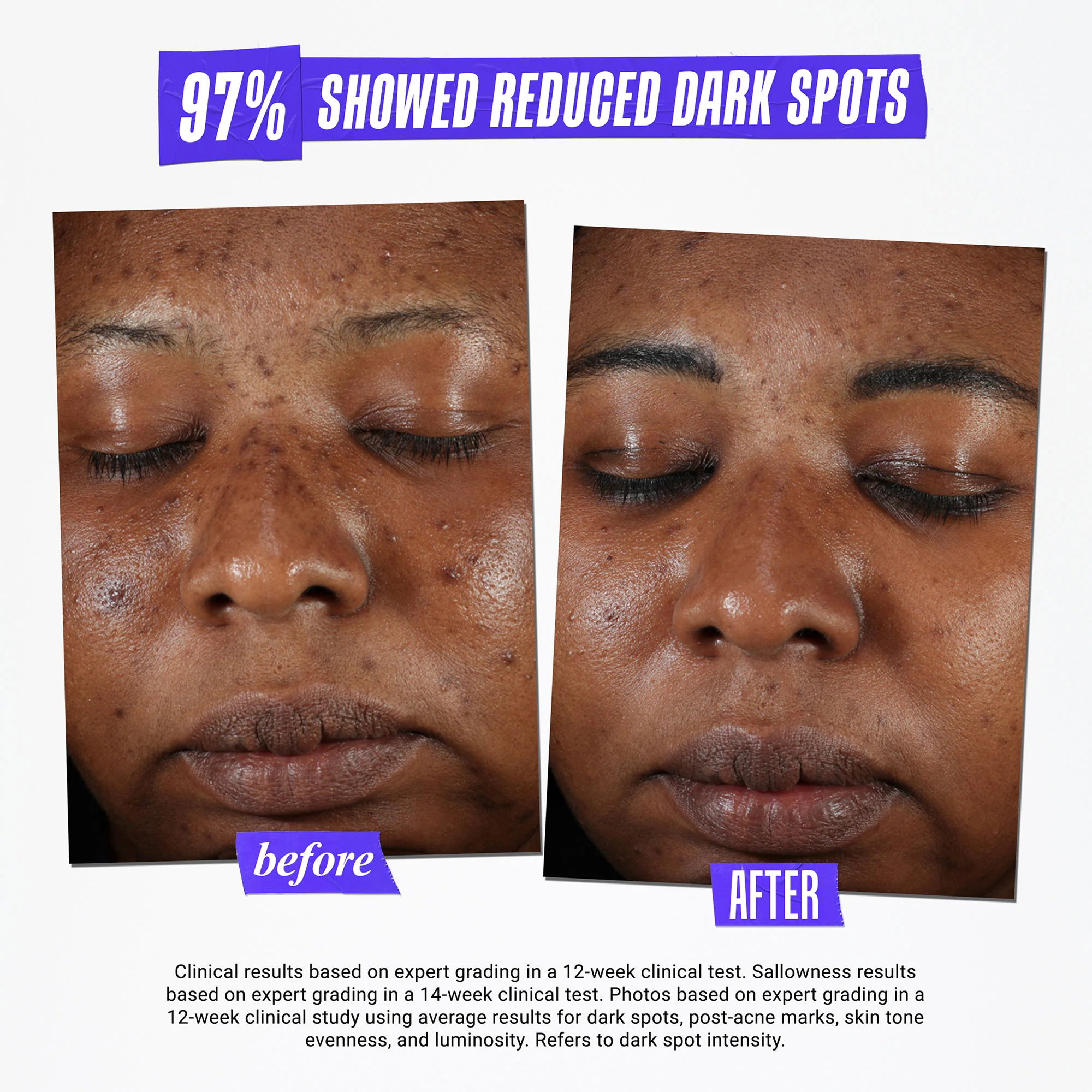 3095-clearly-corrective-dark-spot-solution-6.webp Clearly Corrective Dark Spot Solution