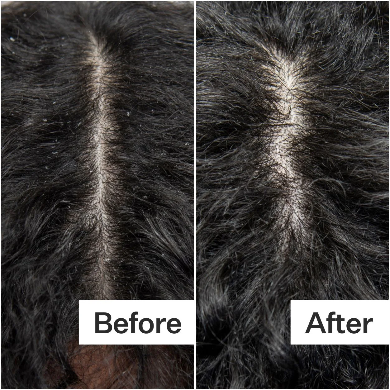 3135-cold-processed-scalp-detox-4.webp Cold Processed Scalp Detox