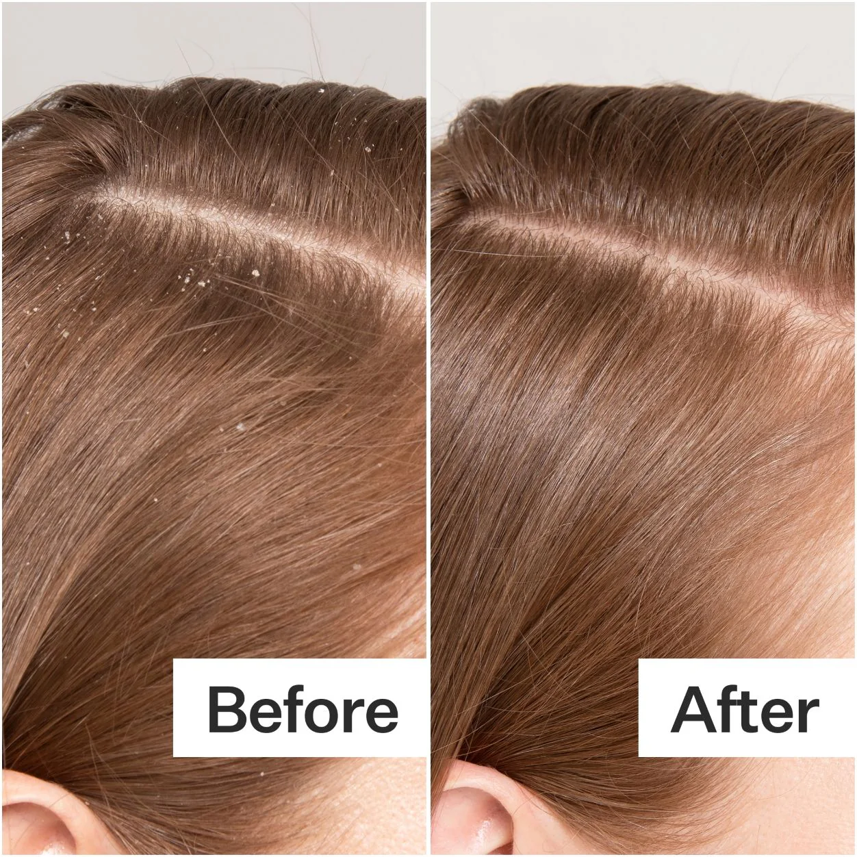 3135-cold-processed-scalp-detox-5.webp Cold Processed Scalp Detox
