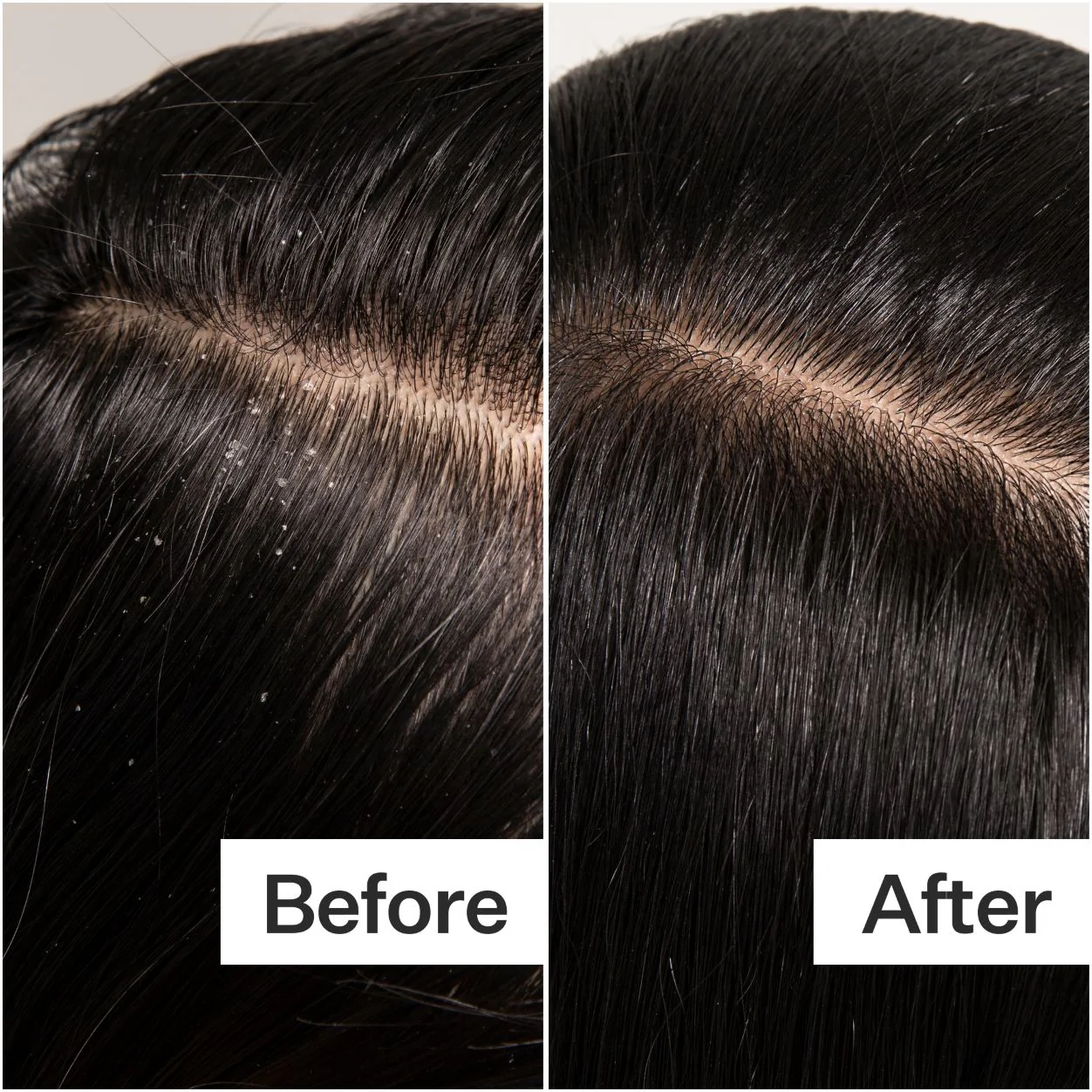 3135-cold-processed-scalp-detox-6.webp Cold Processed Scalp Detox