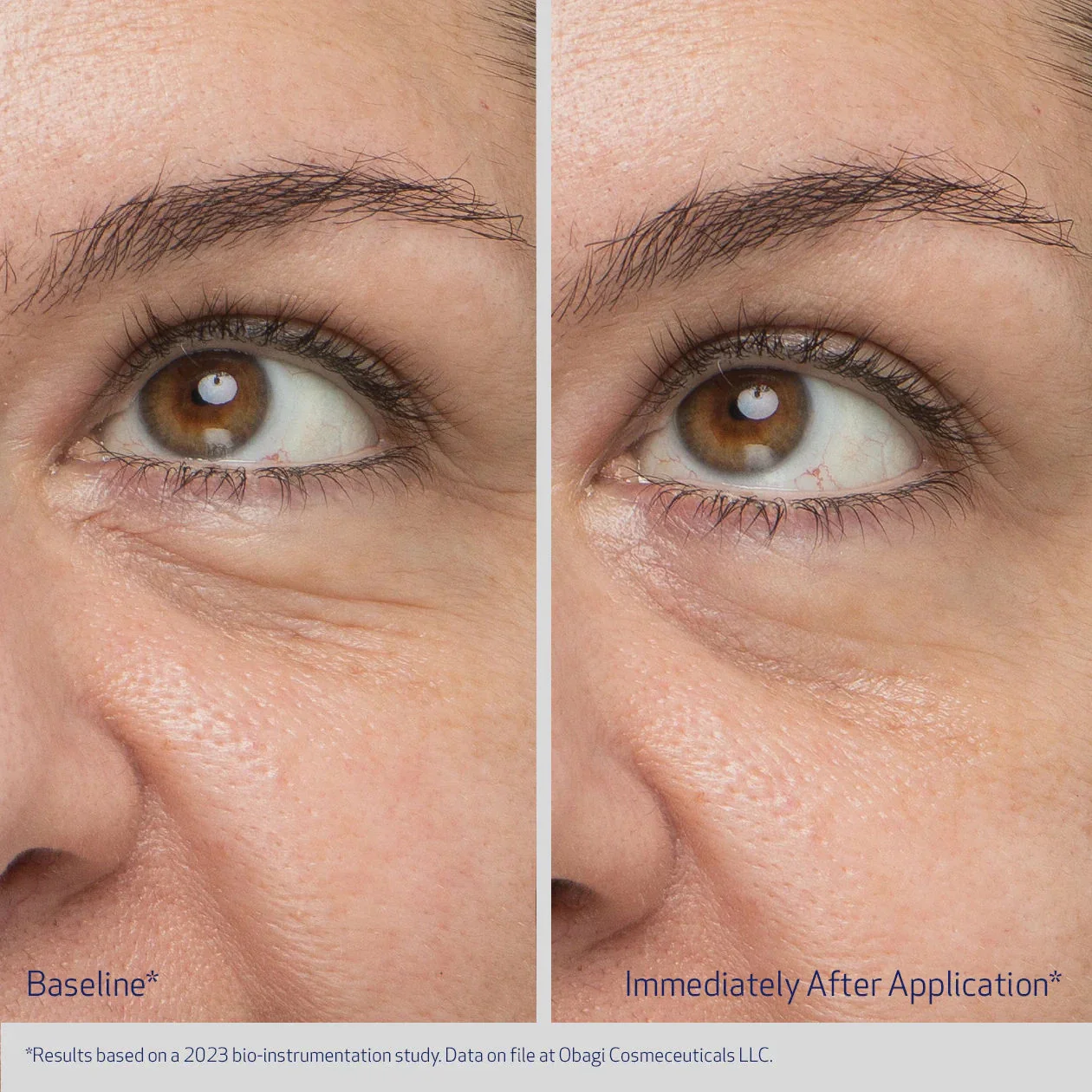 3641-daily-hydro-drops-rejuvenating-eye-gel-cream-2.webp Daily Hydro-Drops Rejuvenating Eye Gel Cream