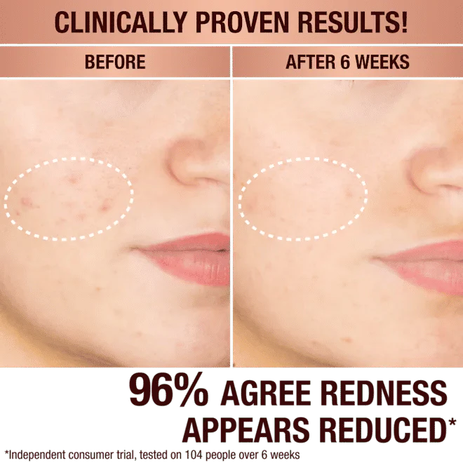 3677-dark-spot-correcting-radiance-recovery-serum-3.webp Dark Spot Correcting Radiance Recovery Serum
