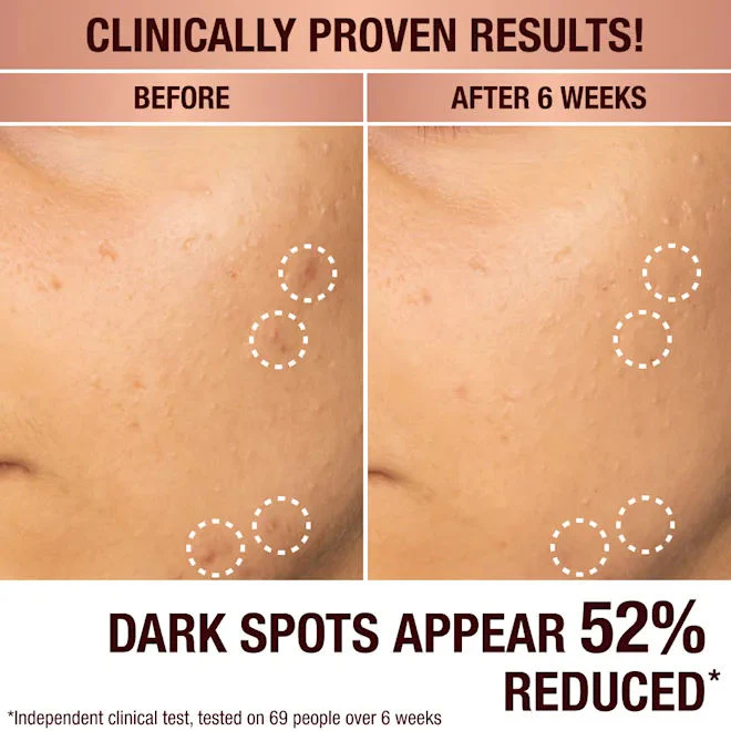 3677-dark-spot-correcting-radiance-recovery-serum-4.webp Dark Spot Correcting Radiance Recovery Serum