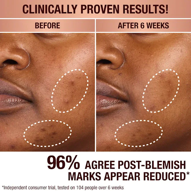 3677-dark-spot-correcting-radiance-recovery-serum-5.webp Dark Spot Correcting Radiance Recovery Serum