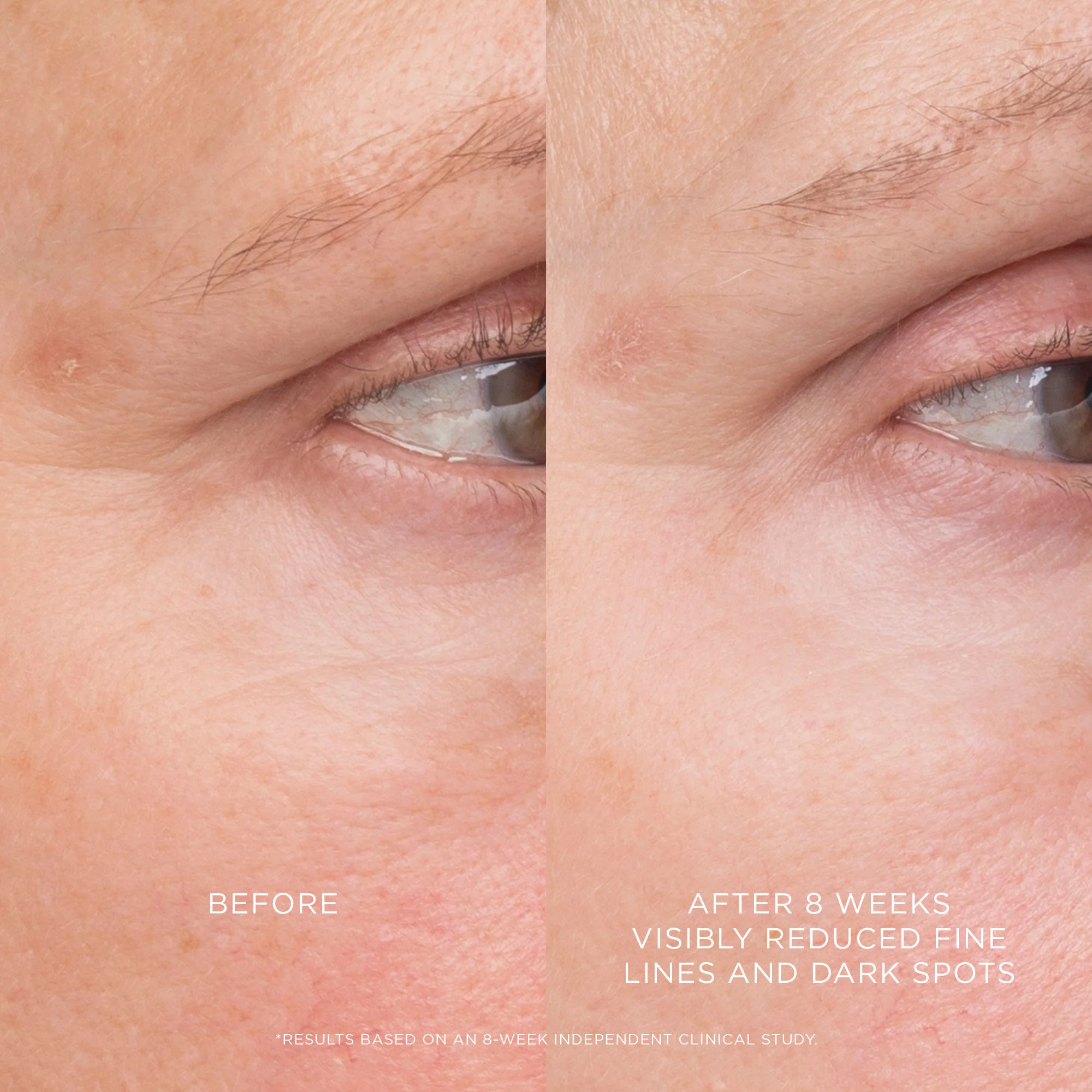 4295-equilibrium-resurfacing-retinoid-treatment-3.webp Equilibrium Resurfacing Retinoid Treatment