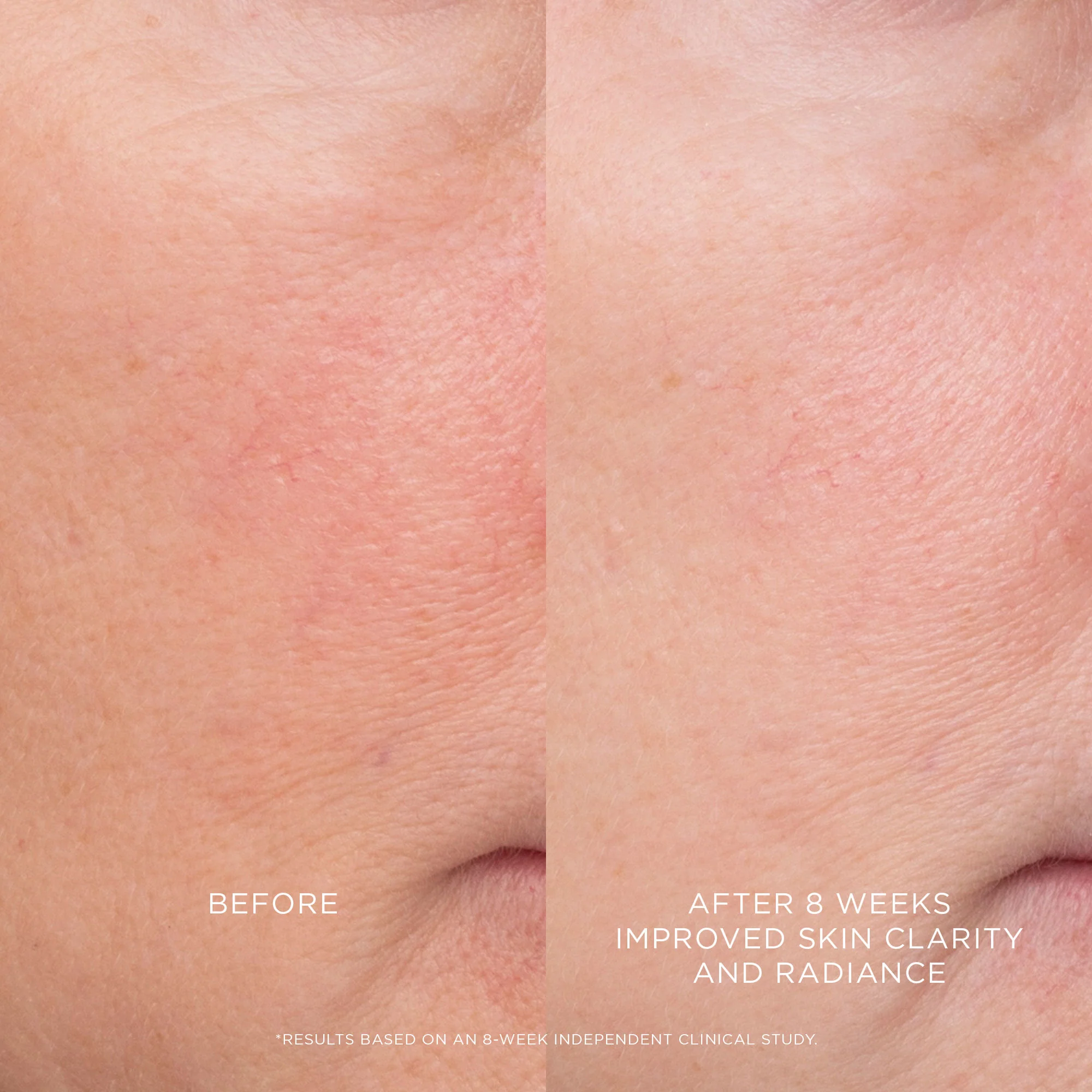 4295-equilibrium-resurfacing-retinoid-treatment-4.webp Equilibrium Resurfacing Retinoid Treatment