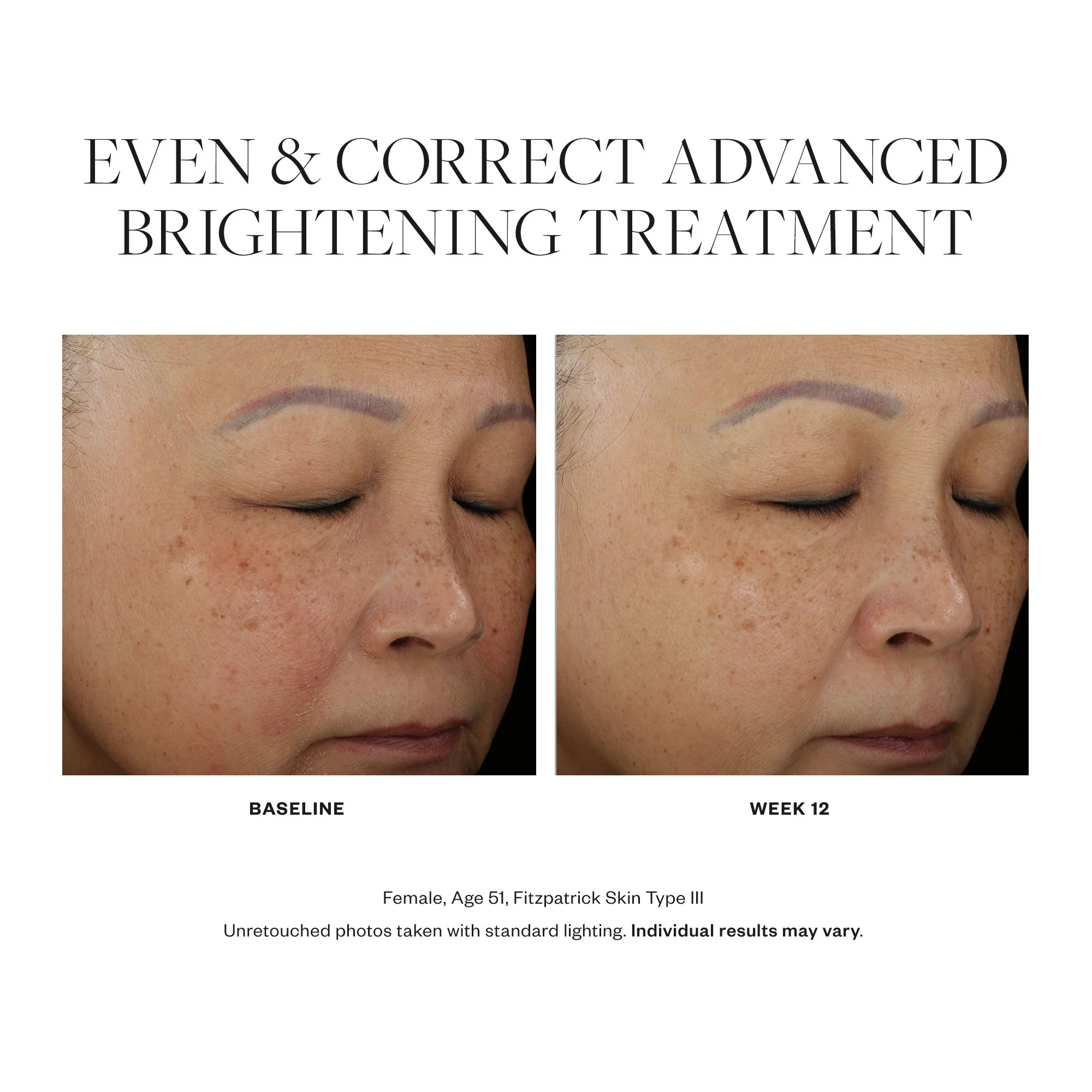 4333-even-correct-advanced-brightening-treatment-4.webp Even & Correct Advanced Brightening Treatment