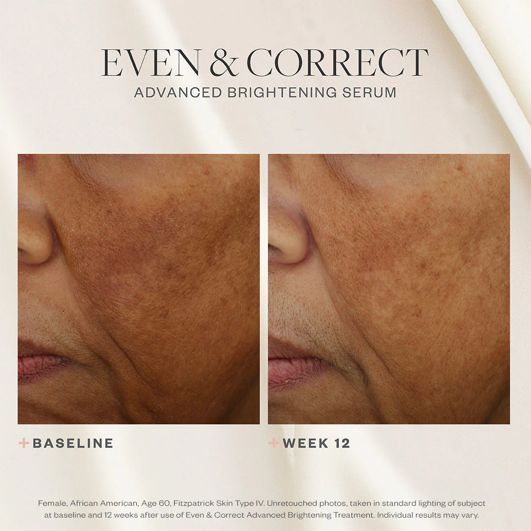 4333-even-correct-advanced-brightening-treatment-5.webp Even & Correct Advanced Brightening Treatment