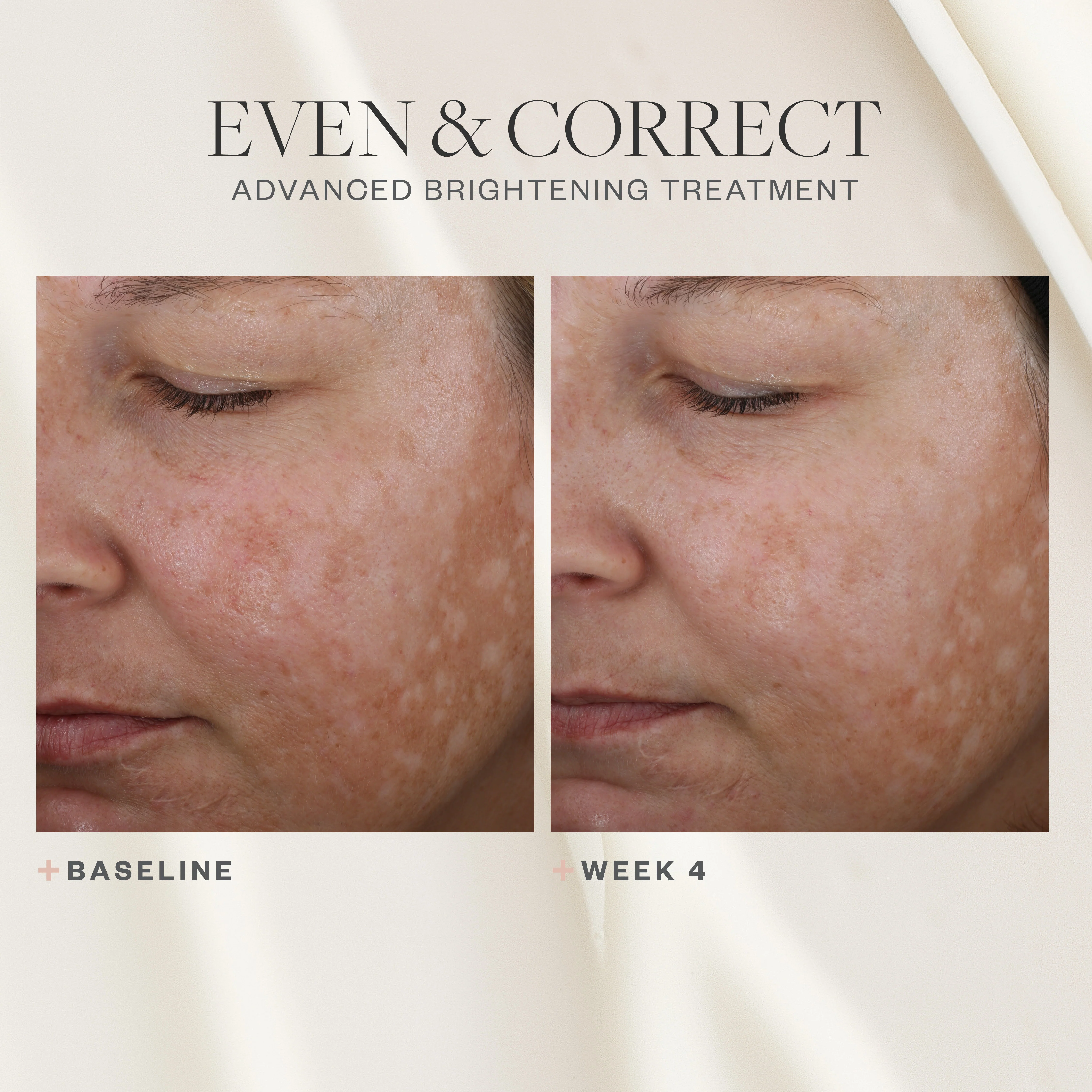 4333-even-correct-advanced-brightening-treatment-6.webp Even & Correct Advanced Brightening Treatment