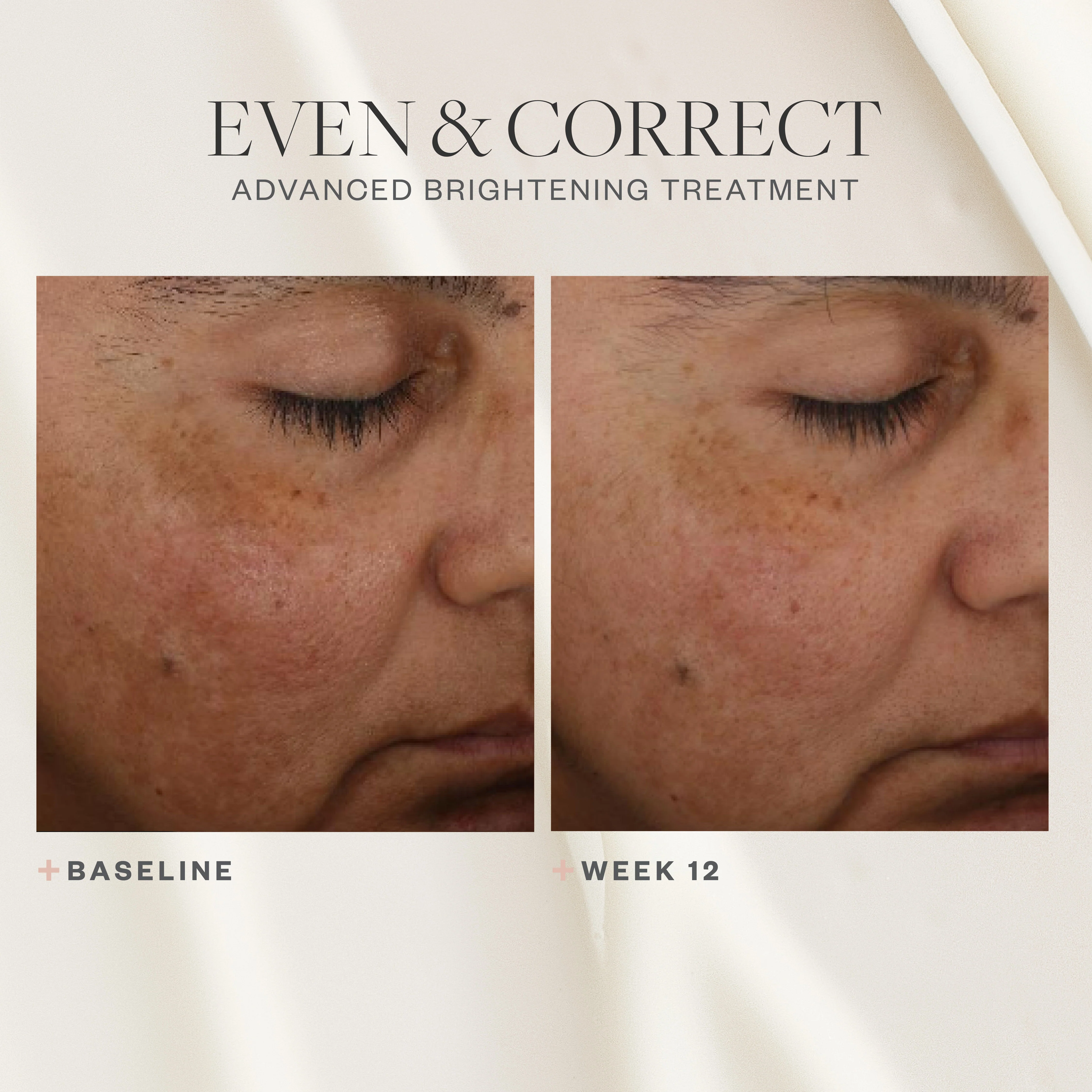 4333-even-correct-advanced-brightening-treatment-7.webp Even & Correct Advanced Brightening Treatment