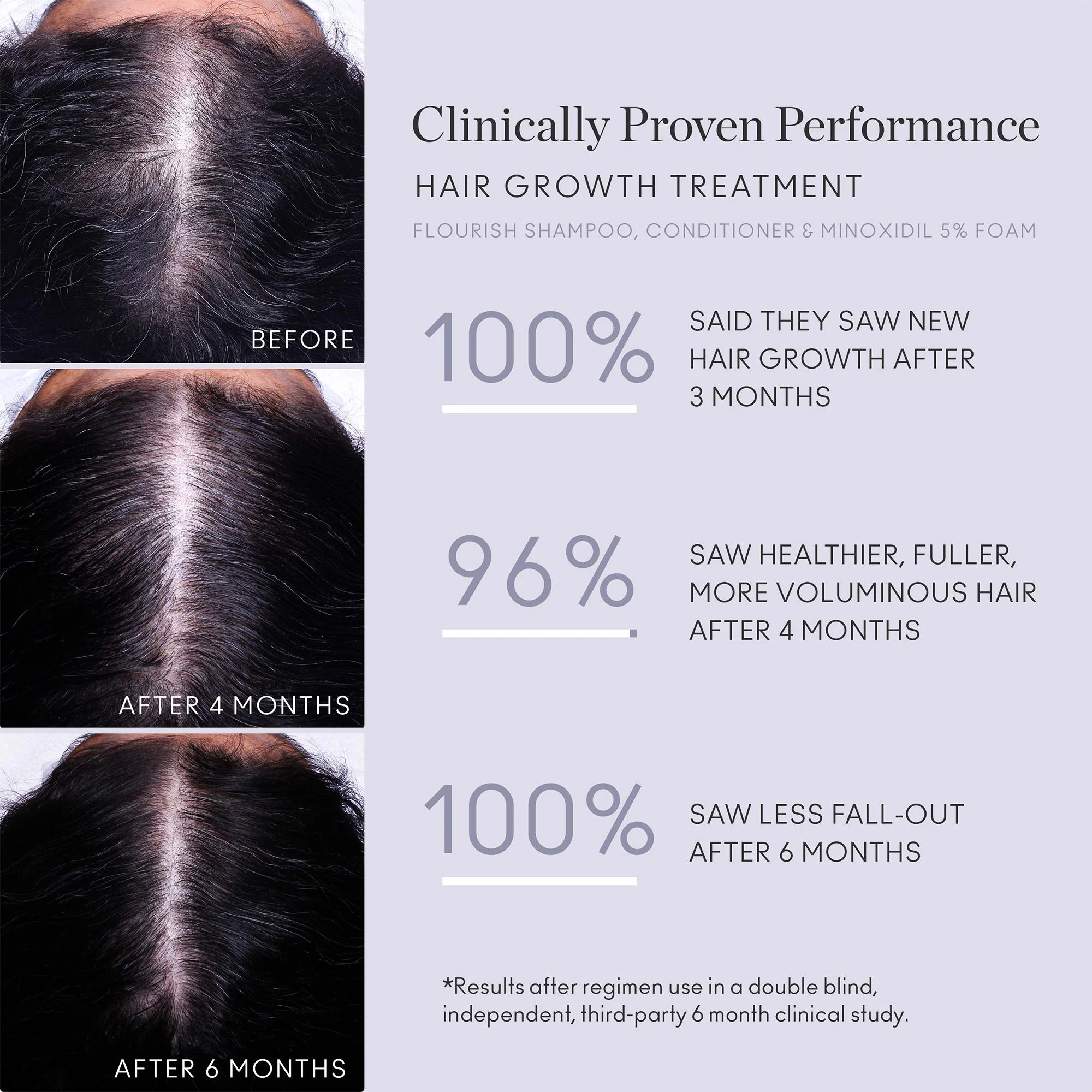 4950-flourish-nightly-intensive-hair-growth-treatment-90-day-4.webp Flourish Nightly Intensive Hair Growth Treatment 90 Day