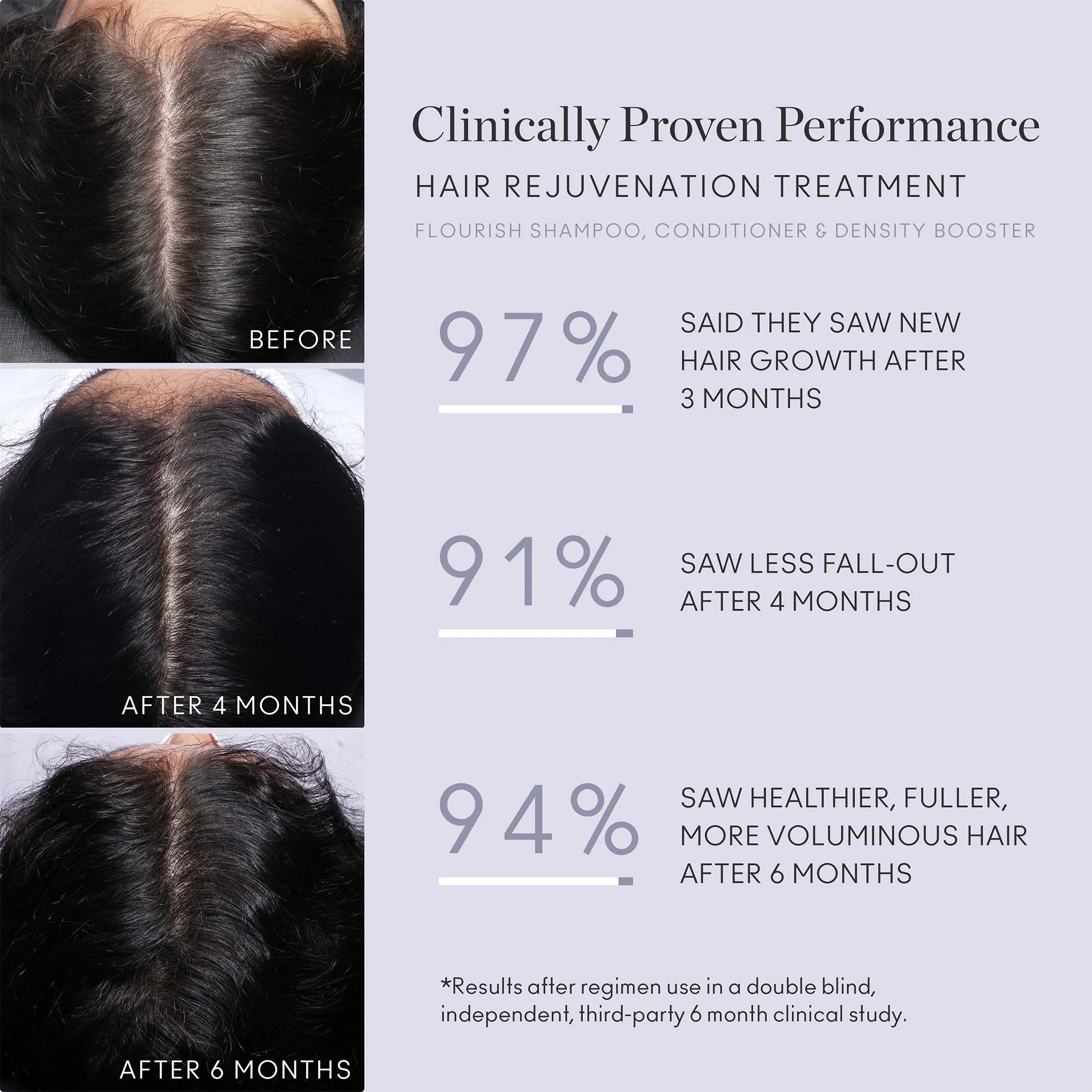 4951-flourish-nightly-intensive-hair-rejuvenation-treatment-30-day-4.webp Flourish Nightly Intensive Hair Rejuvenation Treatment 30 Day