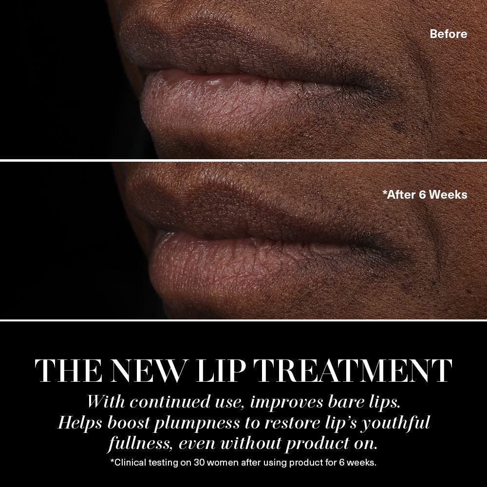 577-the-lip-treatment-5.jpg The Lip Treatment