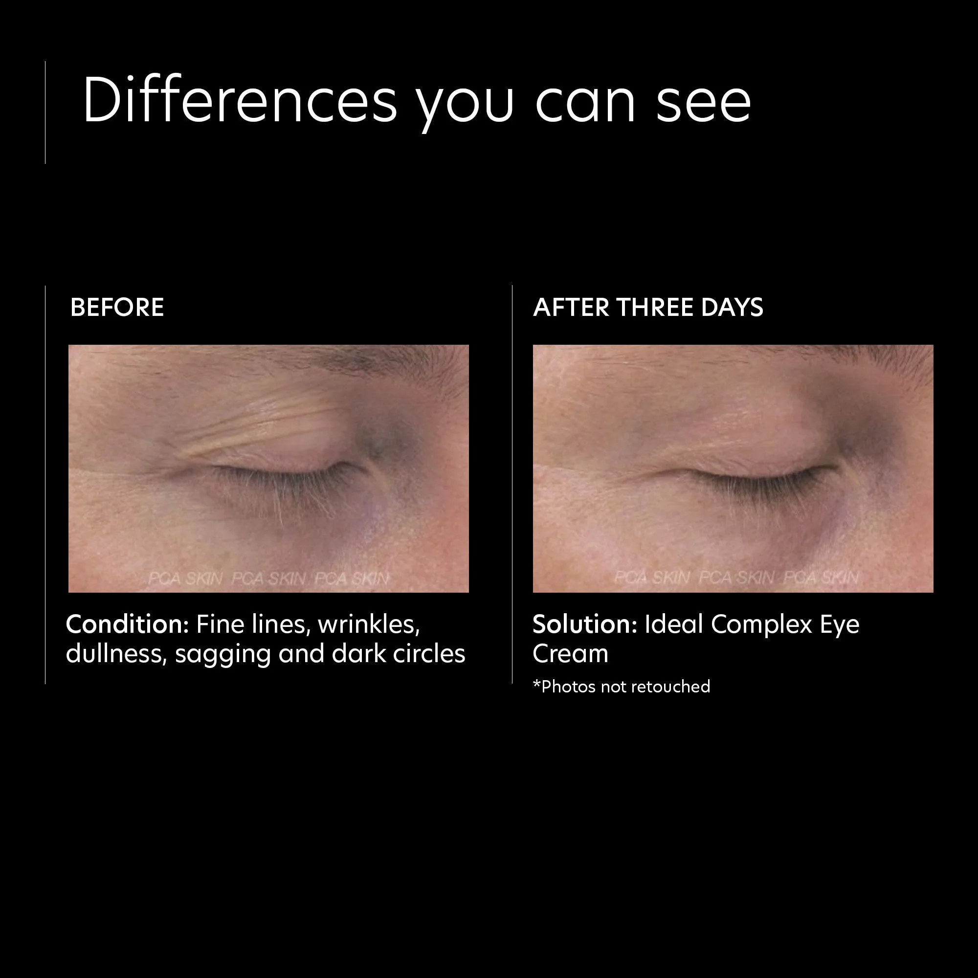 6010-ideal-complex-restorative-eye-cream-3.webp Ideal Complex Restorative Eye Cream