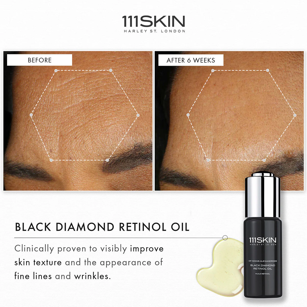 608-black-diamond-retinol-oil-6.webp Black Diamond Retinol Oil